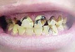 بهترین آزمایش های اعتیاد برای تشخیص کراک| 07642228010